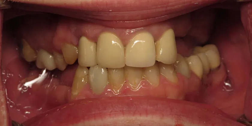 Before image